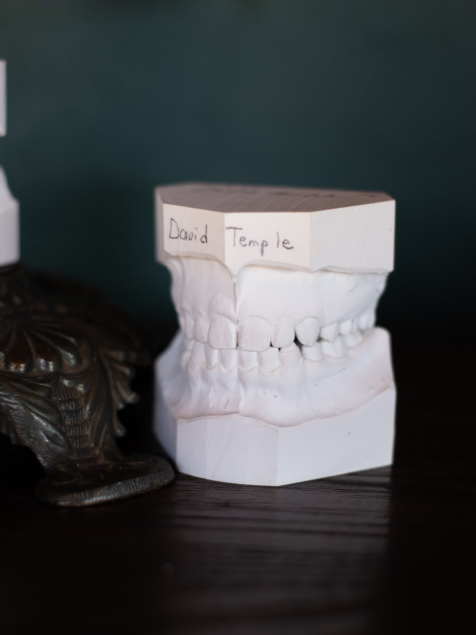 Vintage Dental Cast Model, 1968