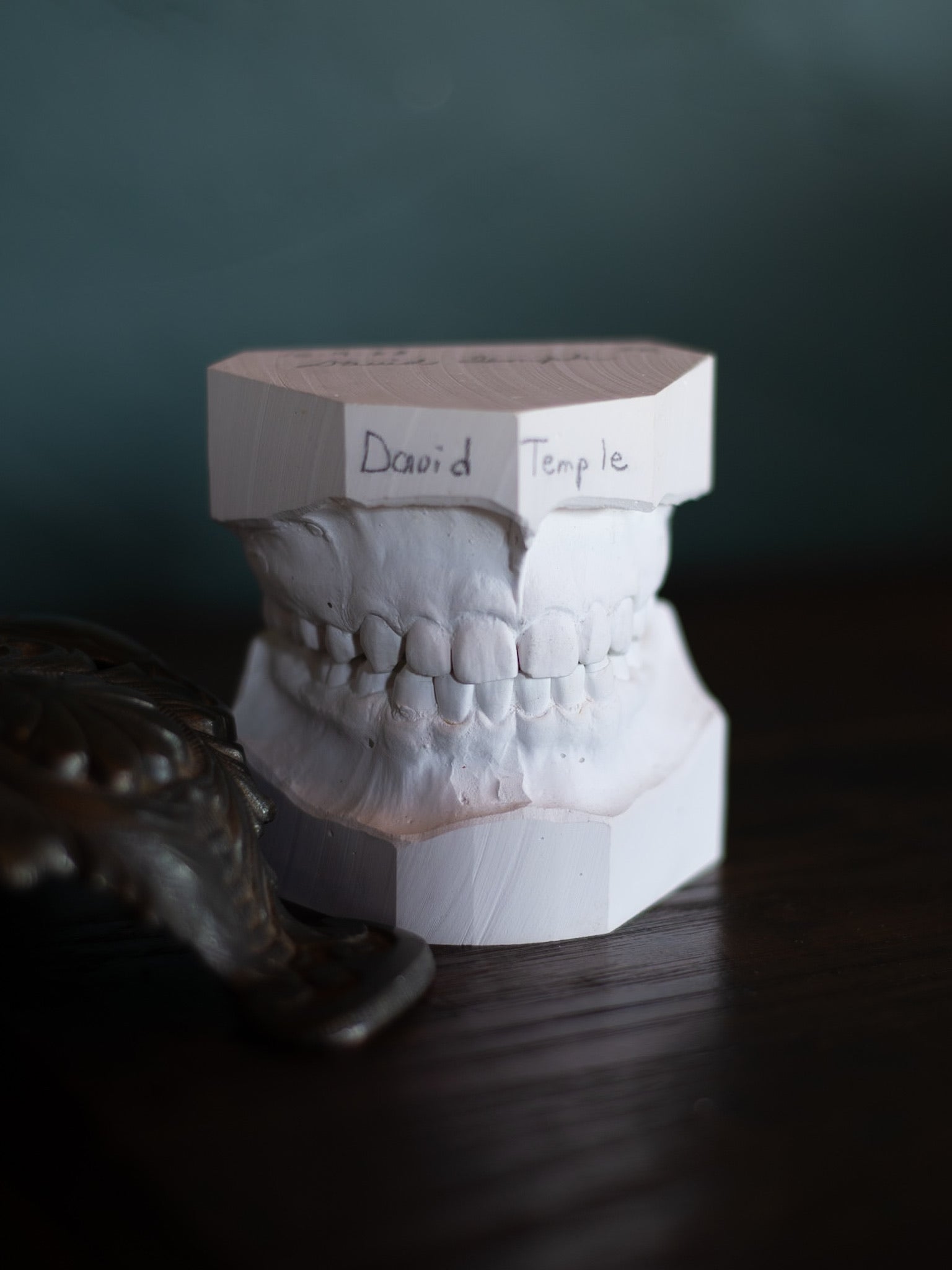 Vintage Dental Cast Model, 1968