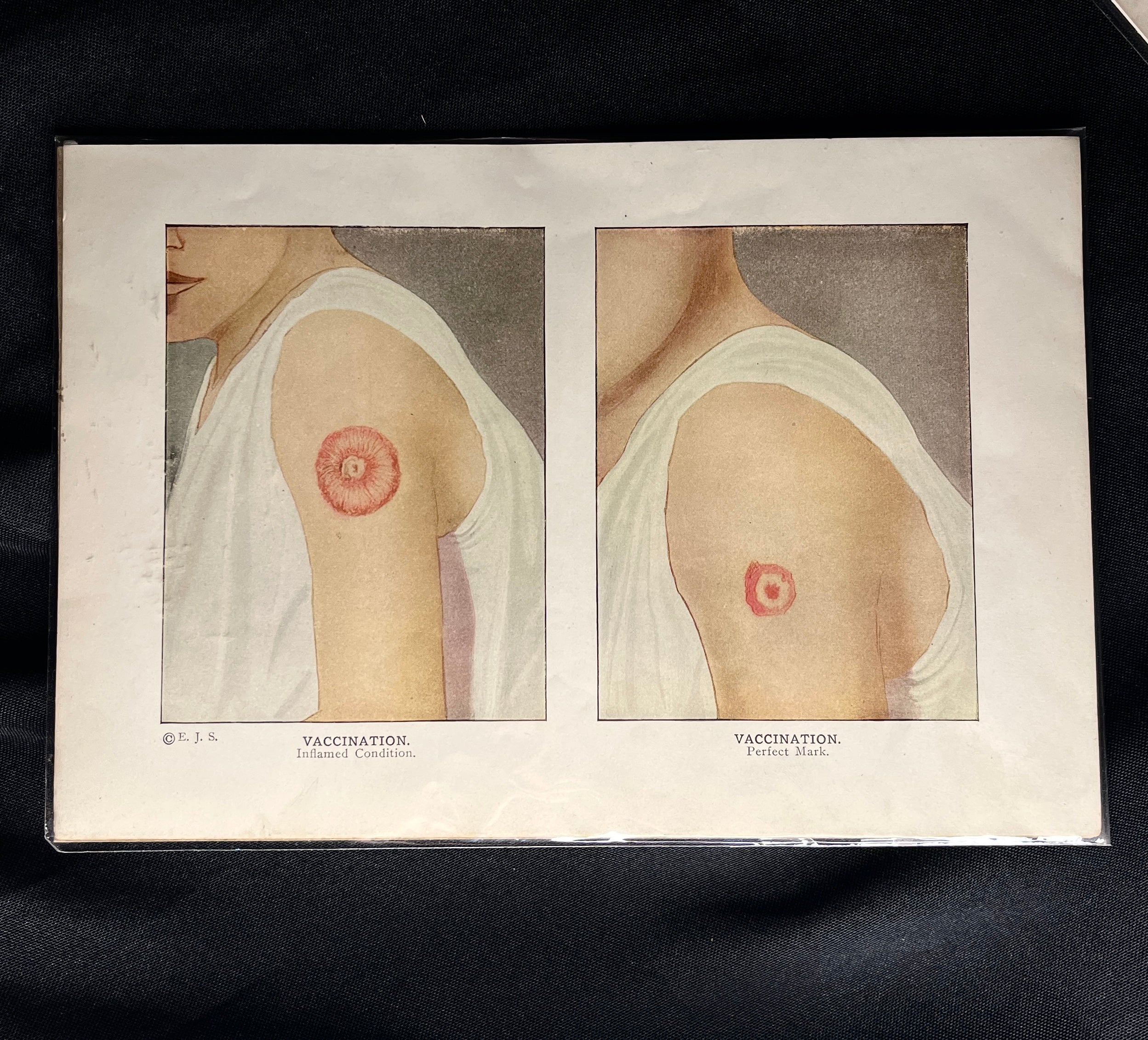 Antique Medical Print, 1890s