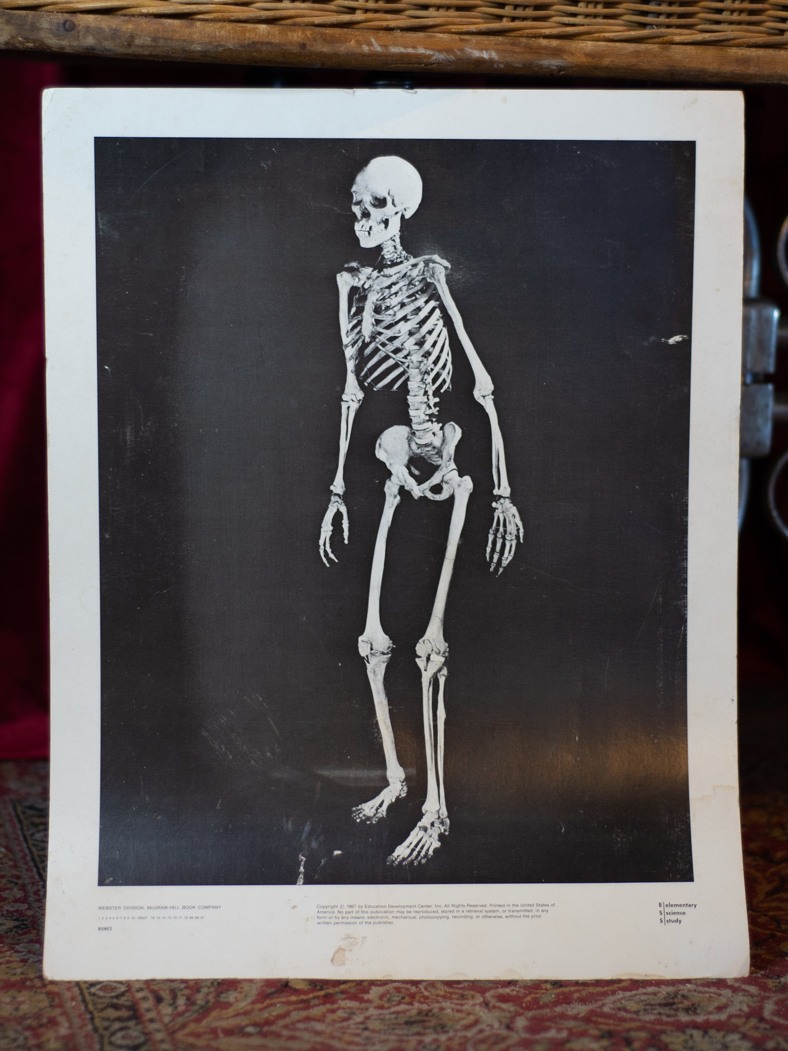 Large Skeleton Print, 1967