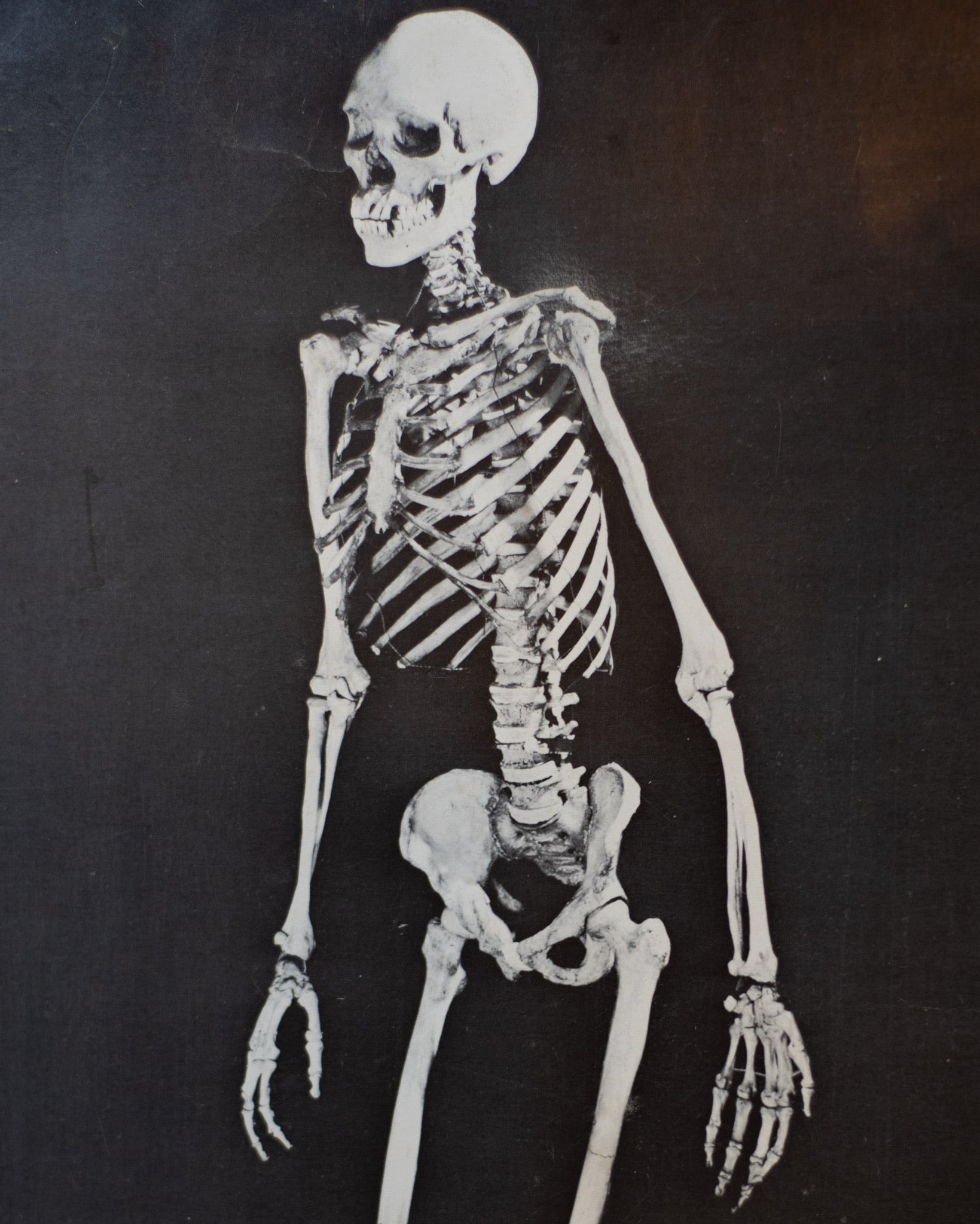 Large Skeleton Print, 1967
