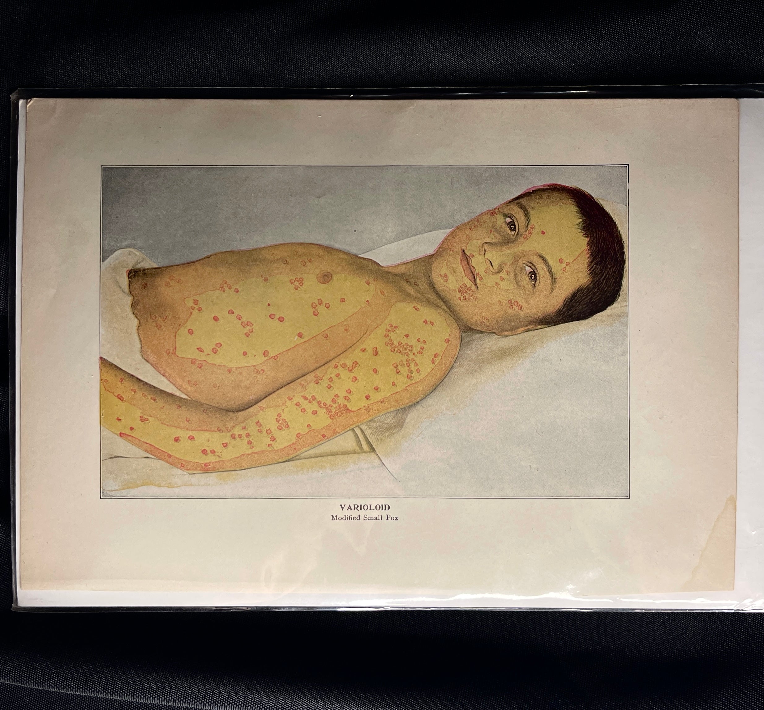 Antique Medical Print, 1890s