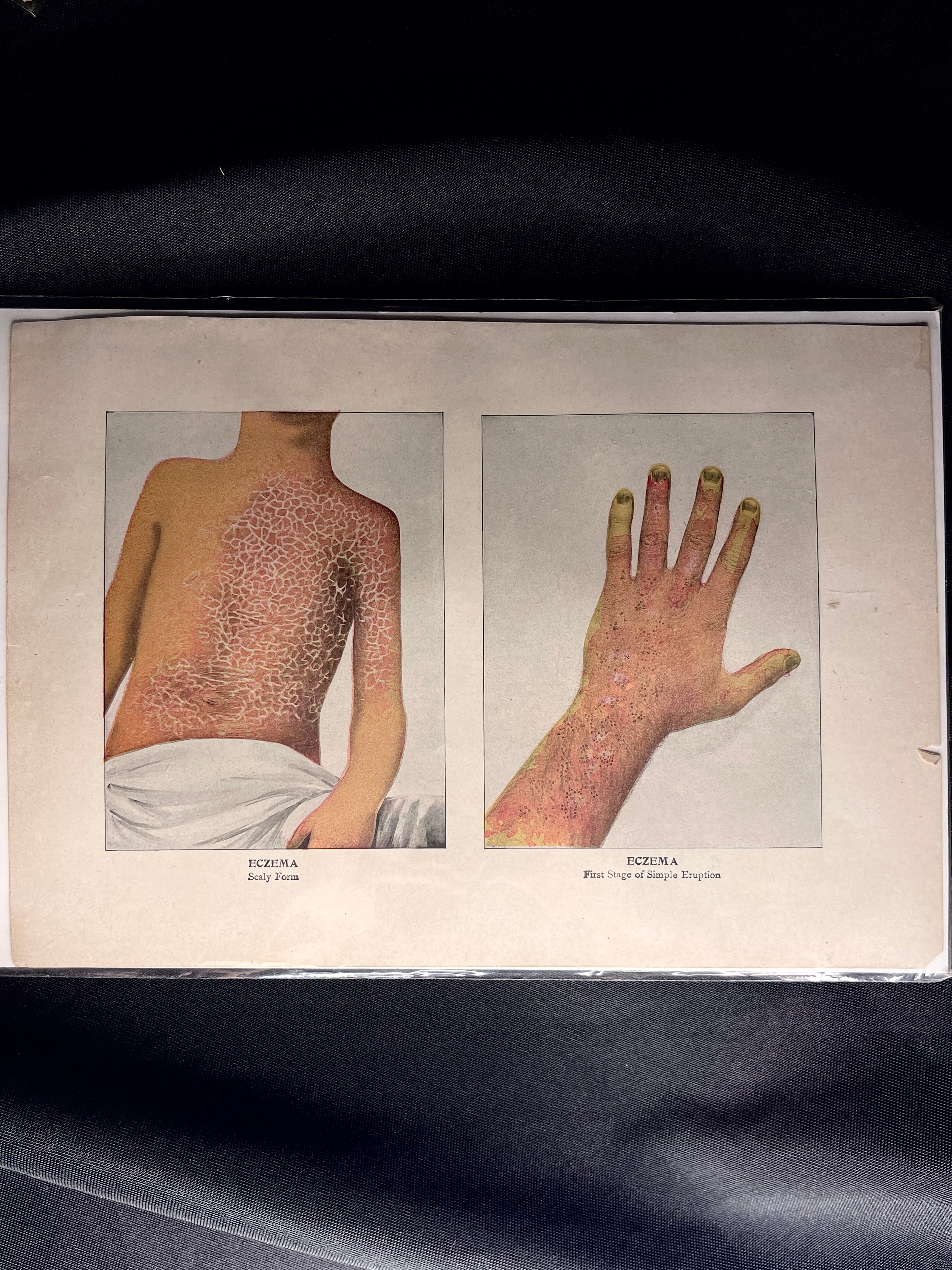 Antique Medical Print, 1890s