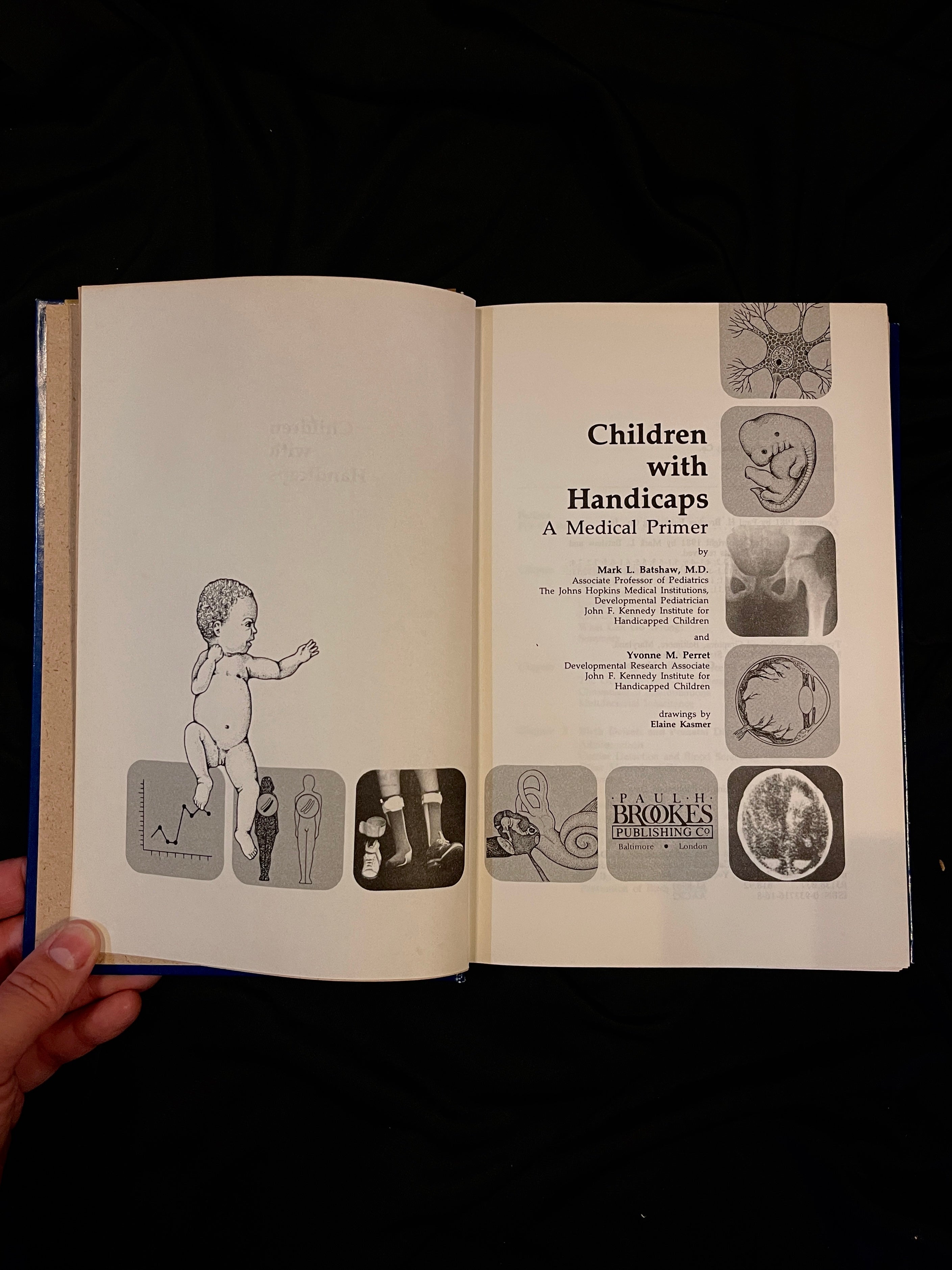 Children with Handicaps, A Medical Primer, 1981