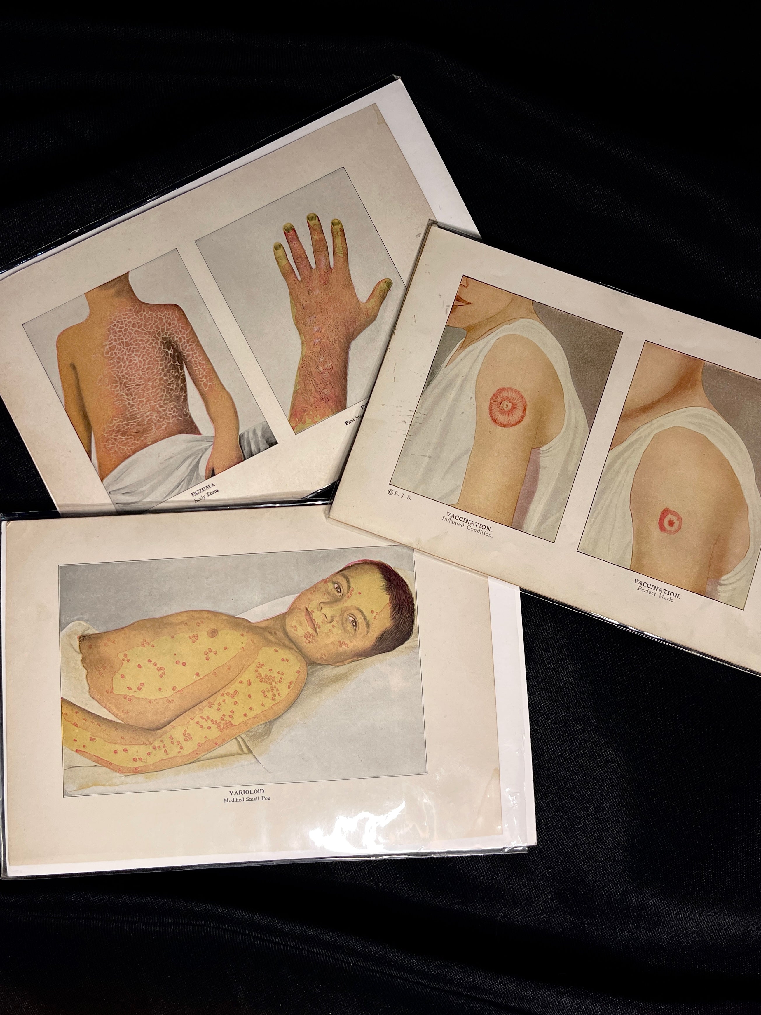 Antique Medical Print, 1890s