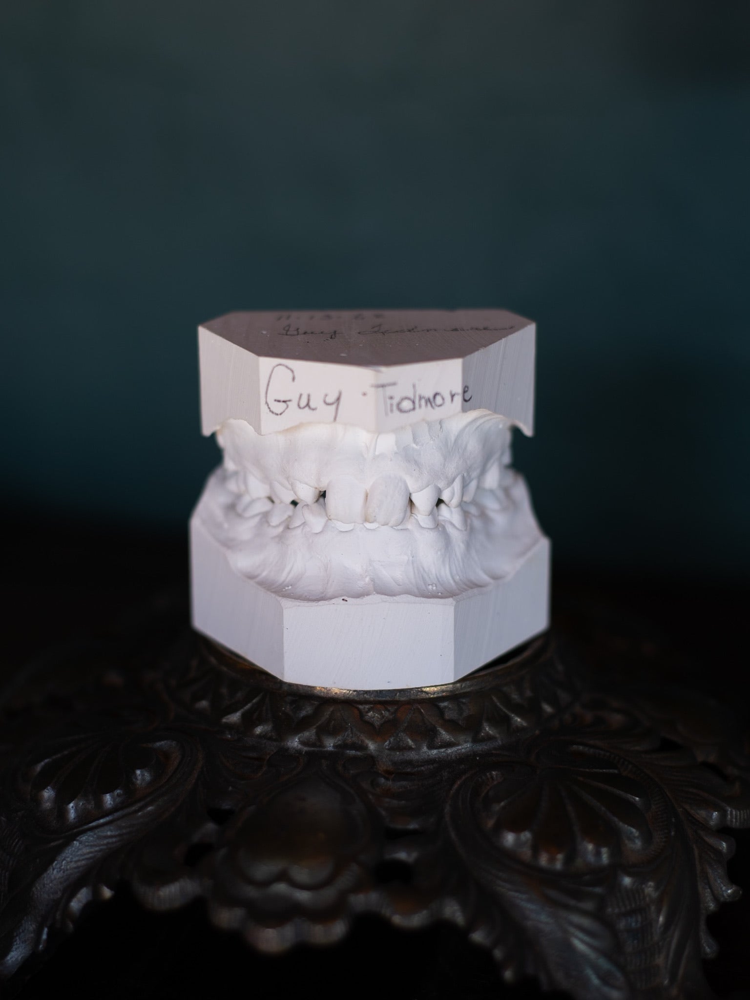 Vintage Dental Cast Model with Malocclusion